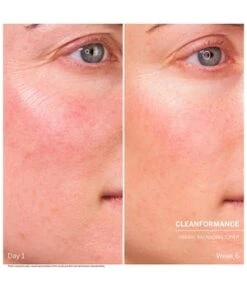 BABOR Doctor Babor Herbal Balancing Toner Gesichtswasser 11 BABOR Doctor Babor Herbal Balancing Toner Gesichtswasser -Schönheit Verkauf babor doctor babor herbal balancing toner gesichtswasser 200 ml 4015165358985 visual2